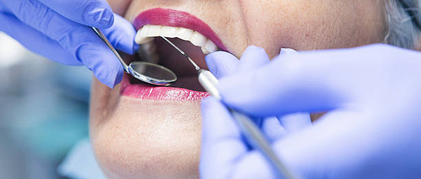 Best Emergency Dental Extractions in Stryker, OH